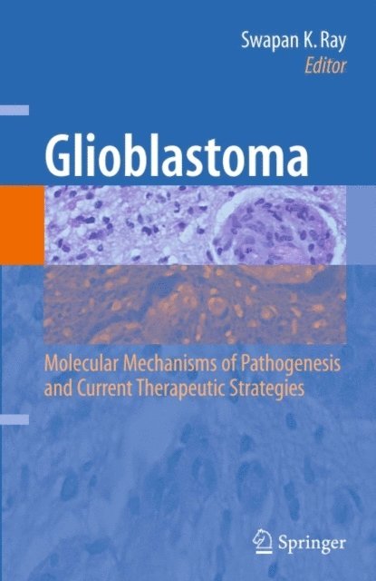 Swapan K. Ray - Glioblastoma:, E-bok