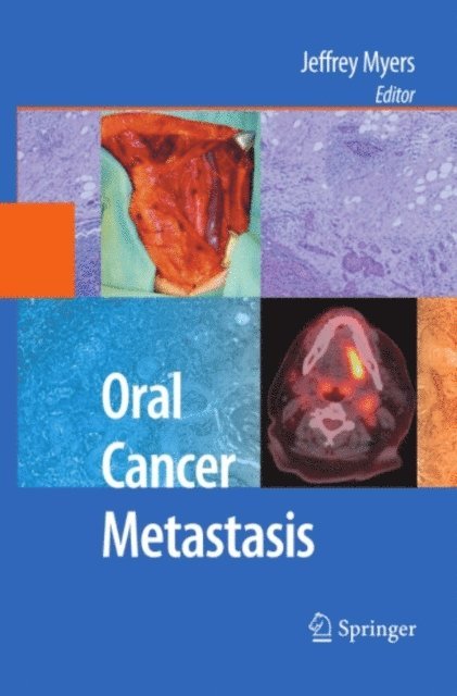 Jeffrey Myers - Oral Cancer Metastasis, E-bok