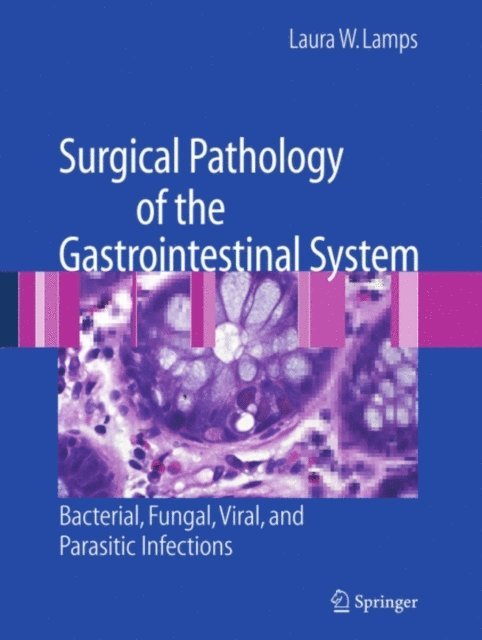 Laura W. Lamps - Surgical Pathology of the Gastrointestinal System: Bacterial, Fungal, Viral, and Parasitic Infections, E-bok