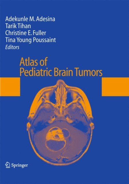 Tina Young Poussaint, Christine E. Fuller, Tarik Tihan, Adekunle M. Adesina - Atlas of Pediatric Brain Tumors, E-bok