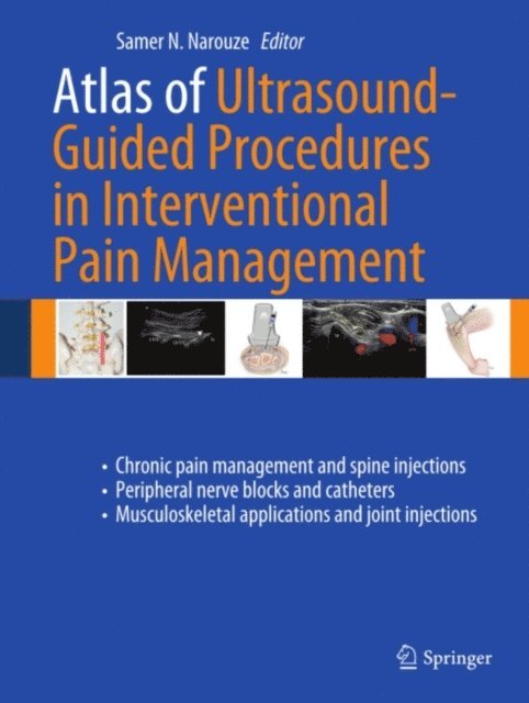 Samer N. Narouze - Atlas of Ultrasound-Guided Procedures in Interventional Pain Management, E-bok