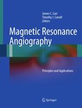 Magnetic Resonance Angiography
