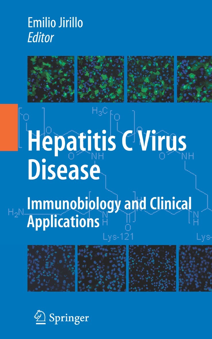 Emilio Jirillo - Hepatitis C Virus Disease, Häftad. Tillgänglighet: Lägg i varukorg
