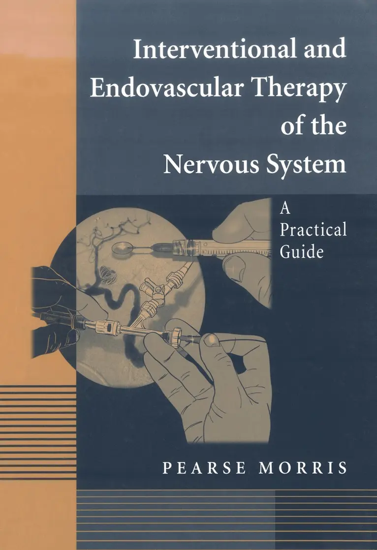 Pearse Morris - Interventional and Endovascular Therapy of the Nervous System, Häftad. Tillgänglighet: Lägg i varukorg