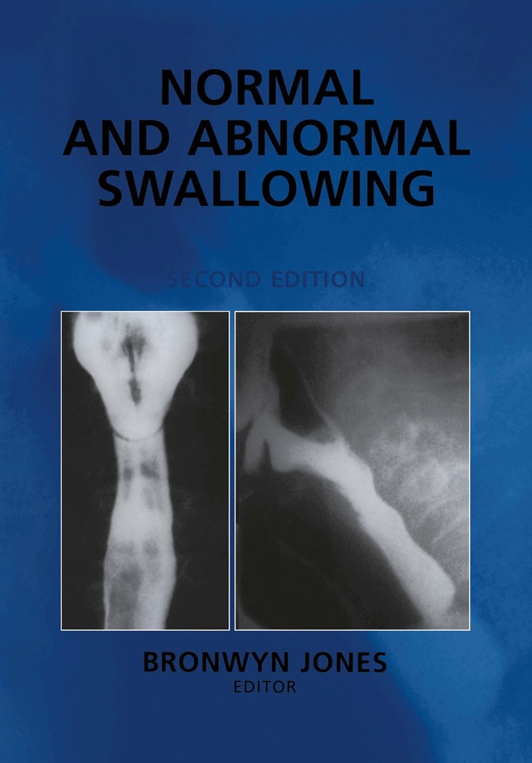 Bronwyn Jones - Normal and Abnormal Swallowing, Häftad