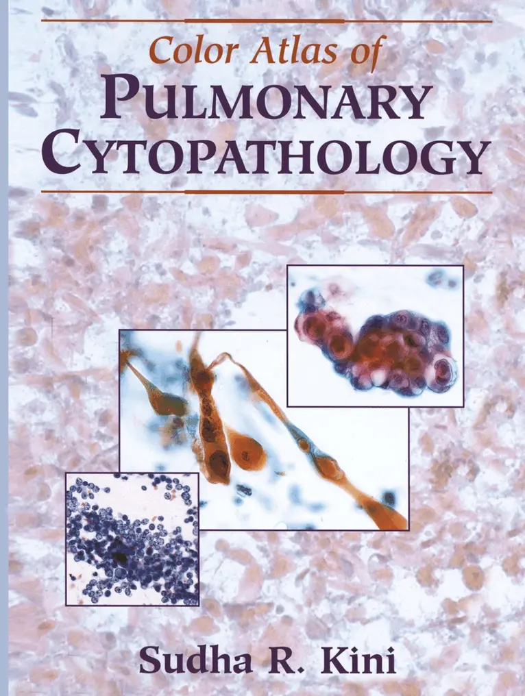 Sudha R. Kini - Color Atlas of Pulmonary Cytopathology, Häftad. Tillgänglighet: Lägg i varukorg