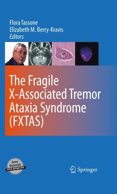 Elizabeth M. Berry-Kravis, Flora Tassone - Fragile X-Associated Tremor Ataxia Syndrome (FXTAS), E-bok