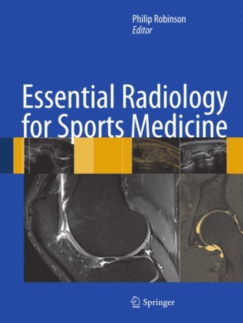 Philip Robinson - Essential Radiology for Sports Medicine, E-bok