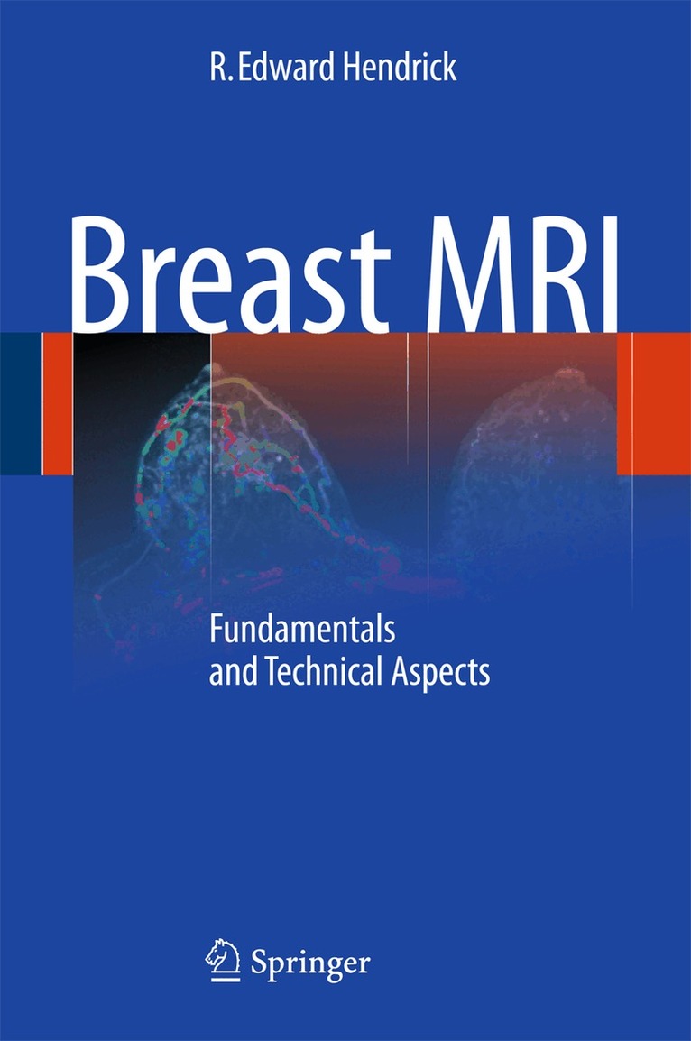 R. Edward Hendrick - Breast MRI, Häftad. Tillgänglighet: Lägg i varukorg