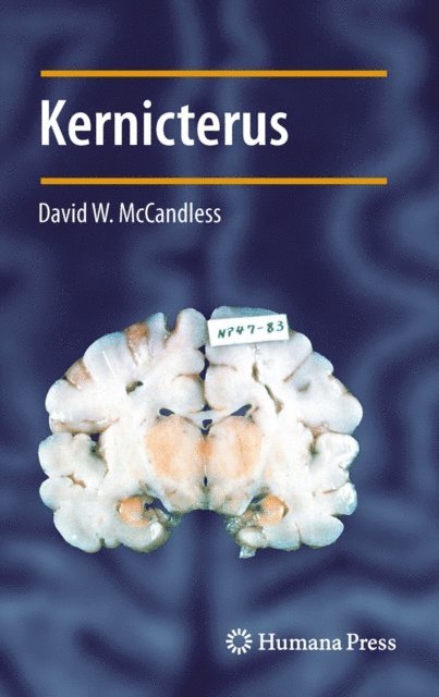 David W. McCandless - Kernicterus, E-bok