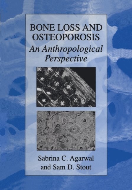 Samuel D. Stout, Sabrina C. Agarwal - Bone Loss and Osteoporosis, E-bok