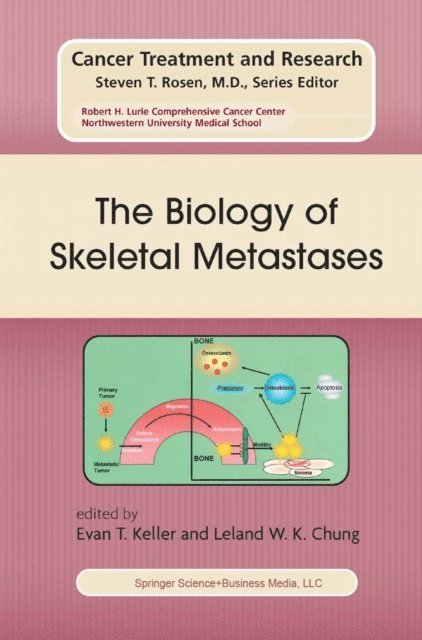 Leland W.K. Chung, Evan T. Keller - Biology of Skeletal Metastases, E-bok