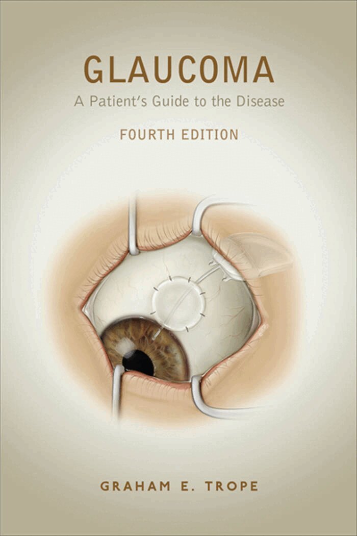 Graham E. Trope - Glaucoma, E-bok. Tillgänglighet: Lägg i varukorg
