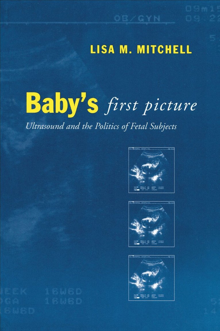 Lisa M. Mitchell - Baby's First Picture, E-bok