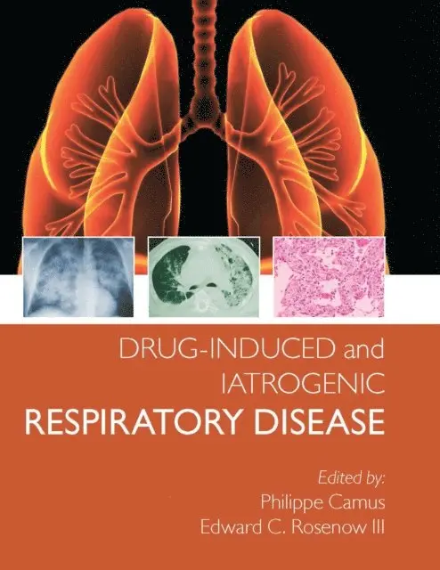 Edward Rosenow III, Phillipe Camus - Drug-induced and Iatrogenic Respiratory Disease, E-bok. Tillgänglighet: Lägg i varukorg