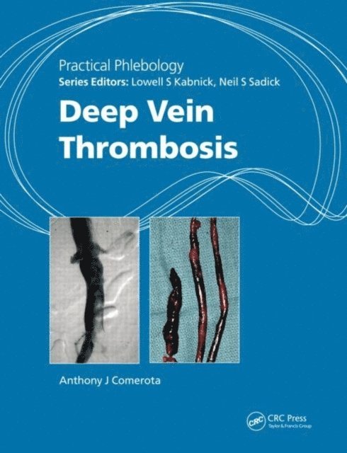 Anthony J. Comerota - Practical Phlebology, E-bok. Tillgänglighet: Lägg i varukorg