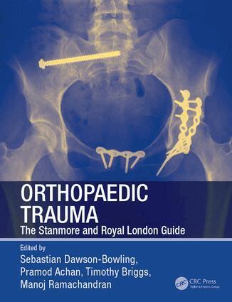 Sebastian Dawson-Bowling, Pramod Achan, Timothy Briggs, Manoj Ramachandran - Orthopaedic Trauma, E-bok
