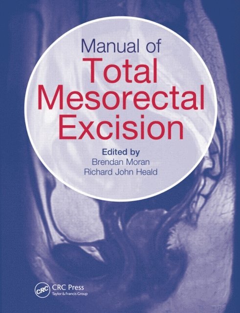 Richard John Heald, Brendan Moran - Manual of Total Mesorectal Excision, E-bok