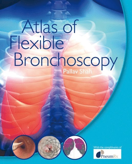 Pallav Shah - Atlas of Flexible Bronchoscopy, E-bok. Tillgänglighet: Lägg i varukorg