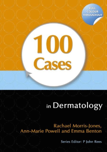Emma Benton, Ann-Marie Powell, Rachael Morris-Jones - 100 Cases in Dermatology, E-bok