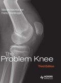 The Problem Knee