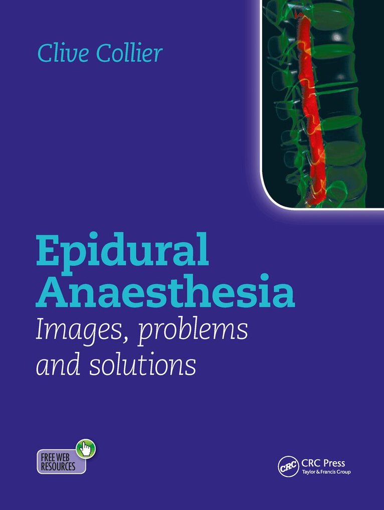 Clive Collier - Epidural Anaesthesia: Images, Problems and Solutions, Inbunden
