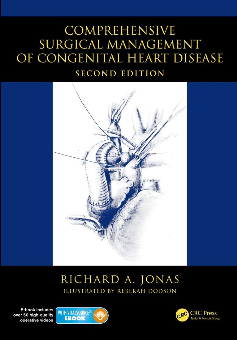 Richard A Jonas - Comprehensive Surgical Management of Congenital Heart Disease, E-bok