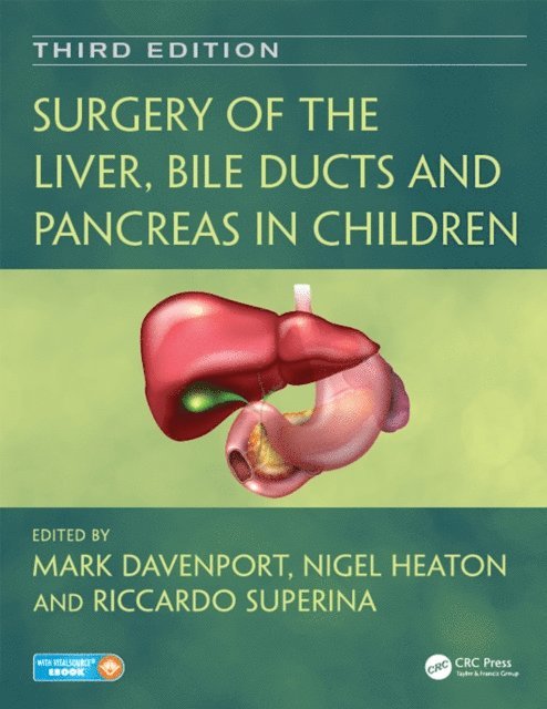 Riccardo Superina, Nigel Heaton, Mark Davenport - Surgery of the Liver, Bile Ducts and Pancreas in Children, E-bok