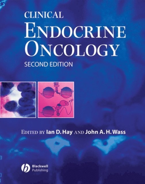 John A. H. Wass, Ian D. Hay - Clinical Endocrine Oncology, E-bok