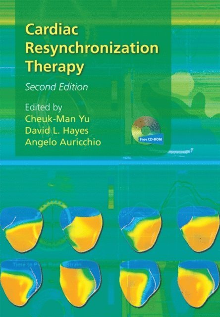 Angelo Auricchio, David L. Hayes, Cheuk-Man Yu - Cardiac Resynchronization Therapy, E-bok