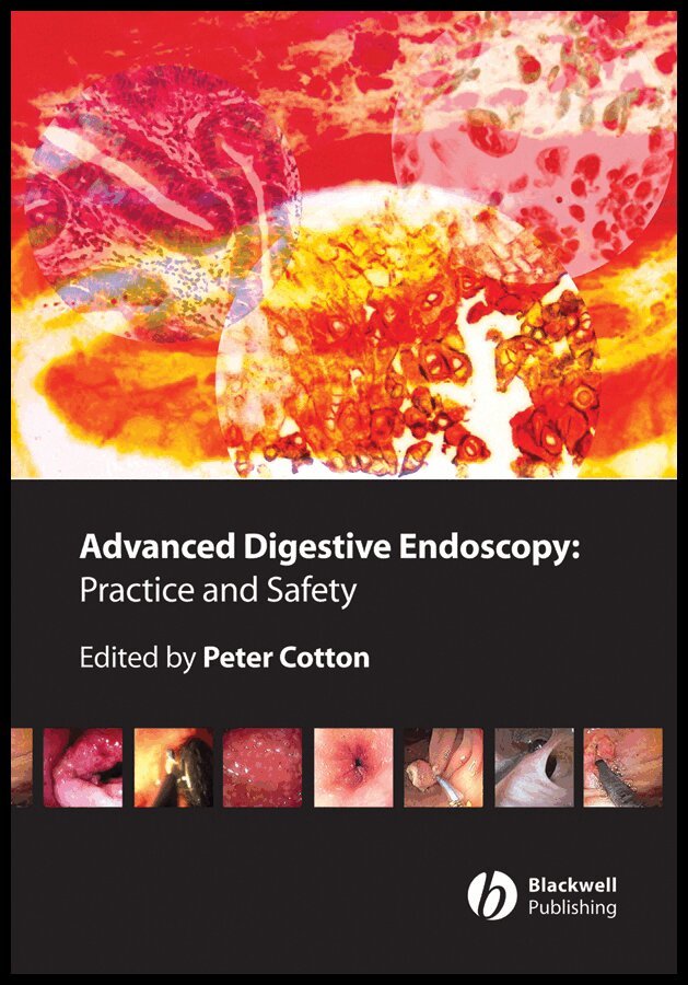 P Cotton - Advanced Digestive Endoscopy – Practice and Safety. Tillgänglighet: Tillfälligt slut