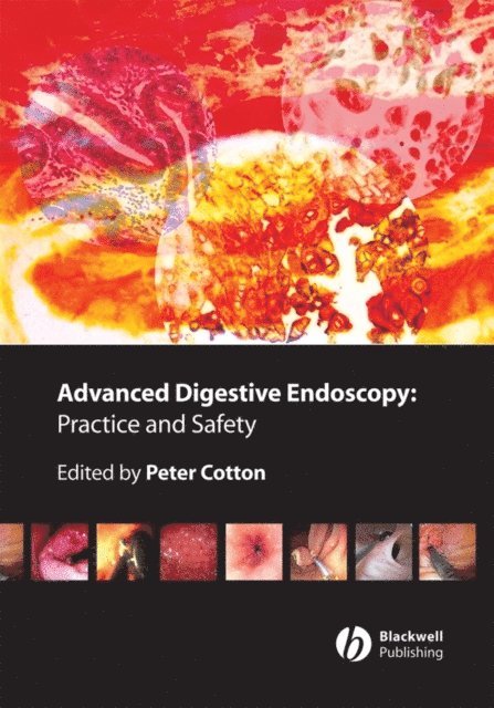 Peter B. Cotton - Advanced Digestive Endoscopy, E-bok