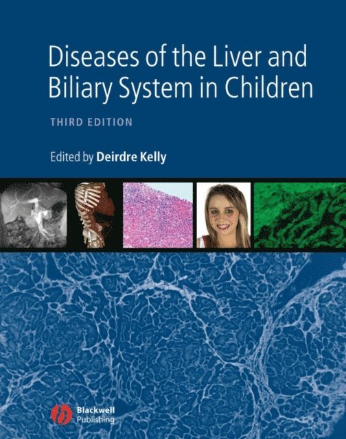 Deirdre A. Kelly - Diseases of the Liver and Biliary System in Children, E-bok