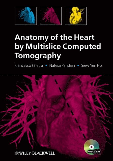 Siew Yen Ho, Natesa Pandian, Francesco Faletra - Anatomy of the Heart by Multislice Computed Tomography, E-bok