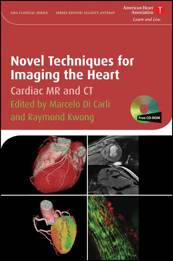 Marcelo F. Di Carli, Raymond Y. Kwong - Novel Techniques for Imaging the Heart – Cardiac MR and CT. Tillgänglighet: Tillfälligt slut