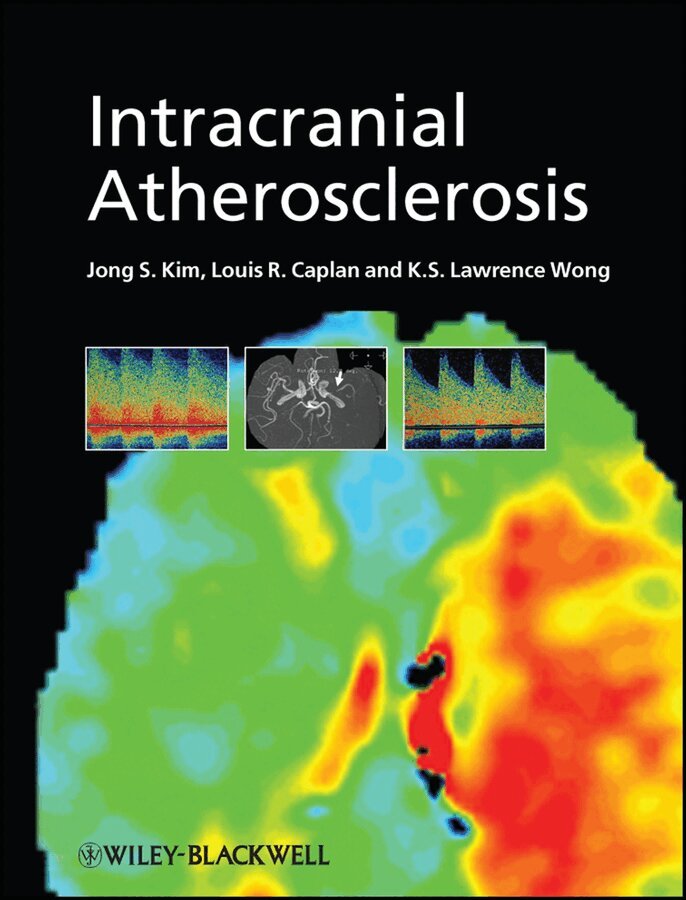 J Kim, Jong S. Kim, Louis R. Caplan, K. S. Lawrence Wong - Intracranial Atherosclerosis. Tillgänglighet: Tillfälligt slut