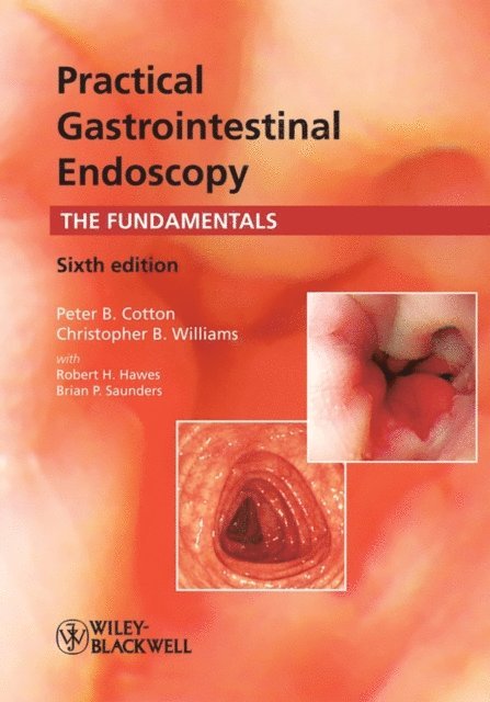 Christopher B. Williams, Peter B. Cotton - Practical Gastrointestinal Endoscopy, E-bok