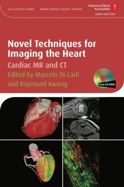 Raymond Y. Kwong, Marcelo F. Di Carli - Novel Techniques for Imaging the Heart, E-bok