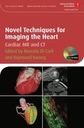 Novel Techniques for Imaging the Heart
