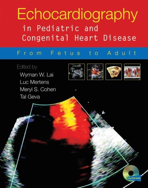 Tal Geva, Meryl S. Cohen, Luc L. Mertens, Wyman W. Lai - Echocardiography in Pediatric and Congenital Heart Disease, E-bok