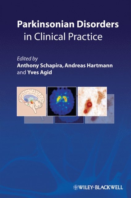 Yves Agid, Andreas Hartmann, Anthony Schapira - Parkinsonian Disorders in Clinical Practice, E-bok