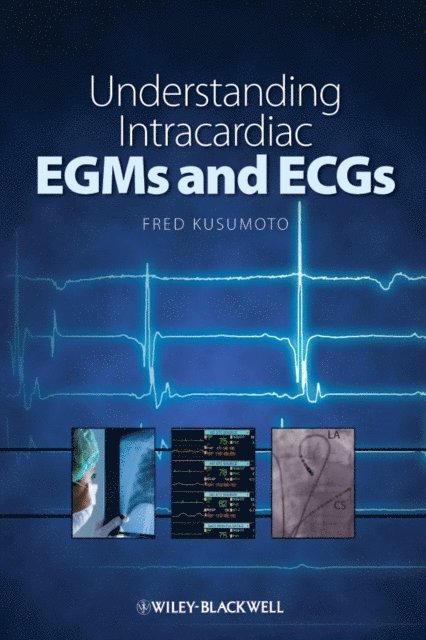 Fred M. Kusumoto - Understanding Intracardiac EGMs and ECGs, E-bok. Tillgänglighet: Lägg i varukorg