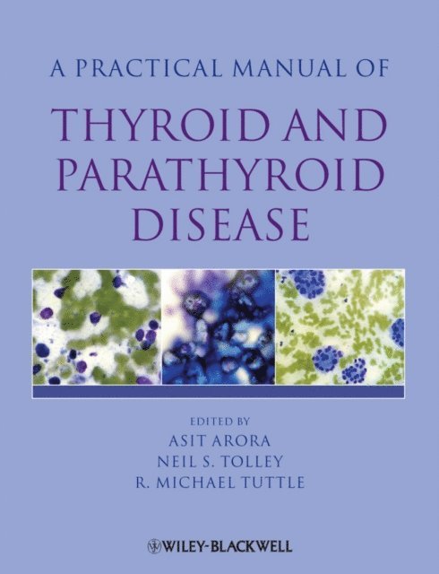 R. Michael Tuttle, Neil Tolley, Asit Arora - Practical Manual of Thyroid and Parathyroid Disease, E-bok