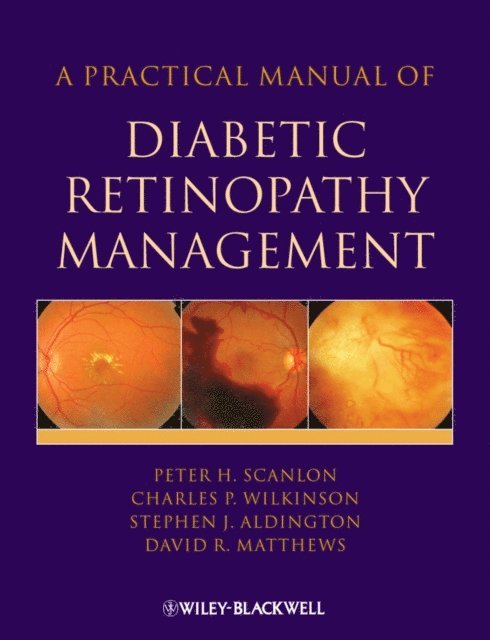 David Matthews, Charles Wilkinson, Stephen Aldington, Peter H. Scanlon - Practical Manual of Diabetic Retinopathy Management, E-bok