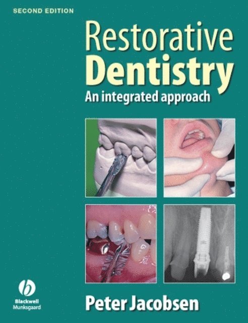 Peter Jacobsen - Restorative Dentistry, E-bok. Tillgänglighet: Lägg i varukorg