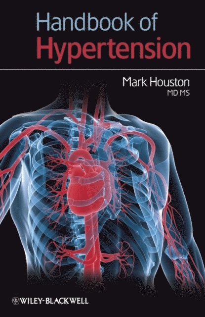Mark Houston - Handbook of Hypertension, E-bok. Tillgänglighet: Lägg i varukorg