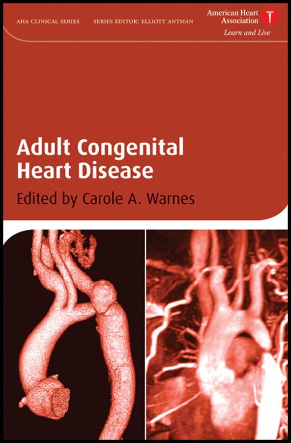 Carole A. Warnes - Adult Congenital Heart Disease. Tillgänglighet: Tillfälligt slut