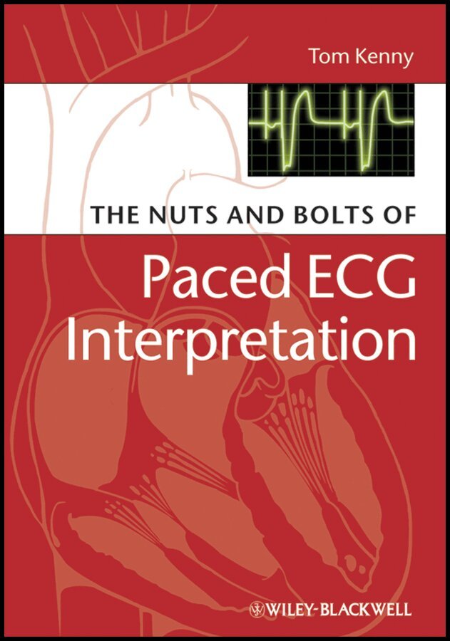 Tom Kenny - Nuts and Bolts of Paced ECG Interpretation oBook. Tillgänglighet: Tillfälligt slut