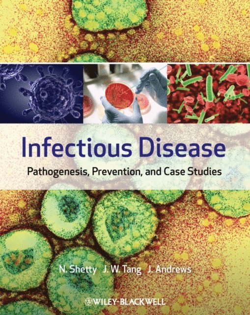 Julie Andrews, Julian W Tang, Nandini Shetty - Infectious Disease, E-bok