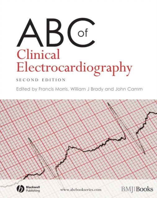 A. John Camm, William J. Brady, Francis Morris - ABC of Clinical Electrocardiography, E-bok